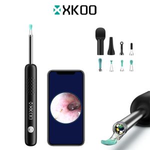 XKOO R1 Pro Otoscope 3-in-1 Earwax Removal Visual Ear Cleaner Visual Pimple Blackhead Remover Ear Speculum Oral Speculum Silicone